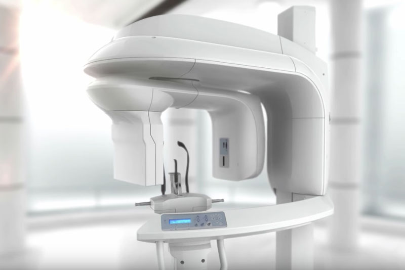 cbct scanner graphic