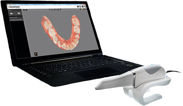 intraoral scanner