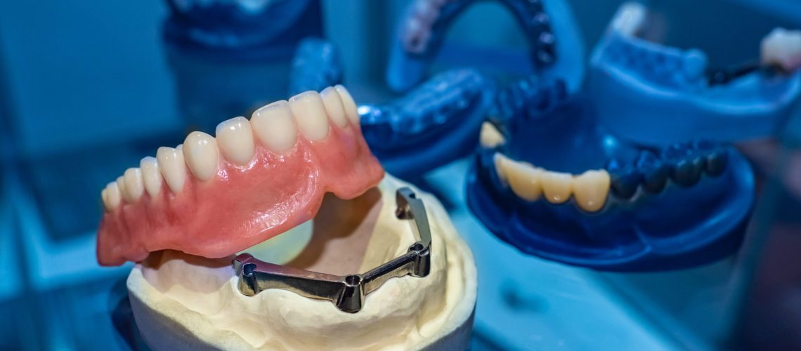 image of a dental implant denture on a prosthesis jaw in a dark and blue aesthetic dental room.