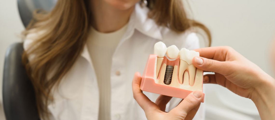 Dental Patient Getting Shown A Dental Implant Model During Her Consultation in Jacksonville, FL