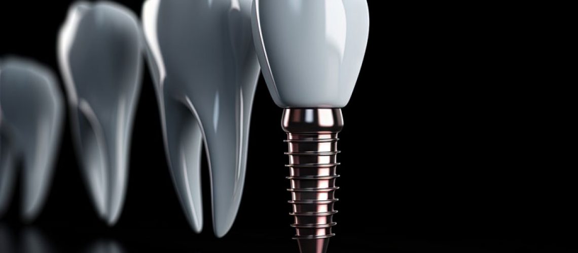 Digital model of a dental implant on a blacked out background.